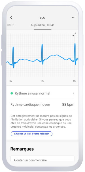 Smart blood pressure monitor with ECG & digital stethoscope - BPM Core